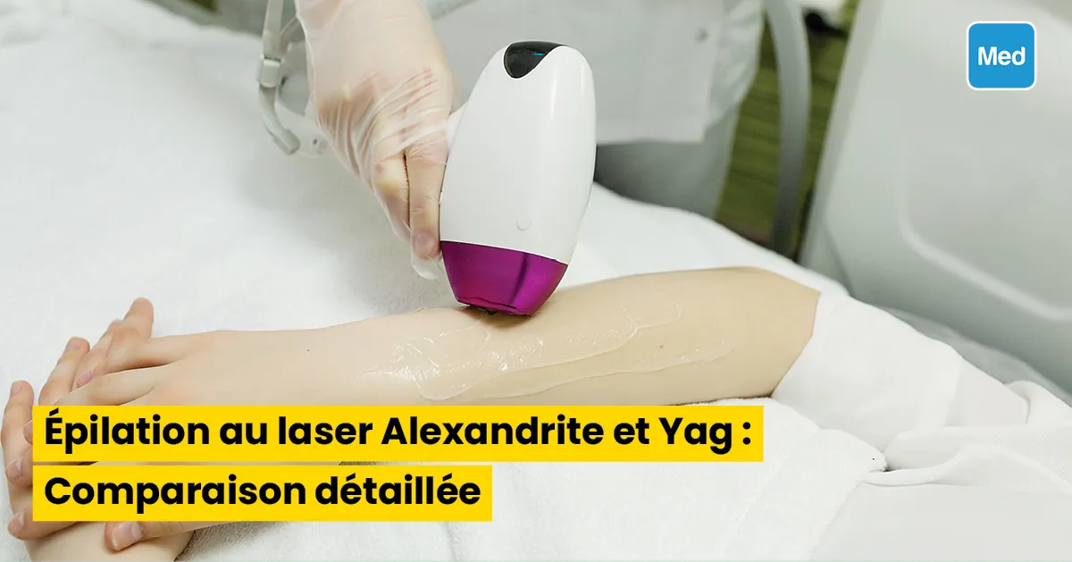 Épilation au laser Alexandrite et Yag : Comparaison détaillée
